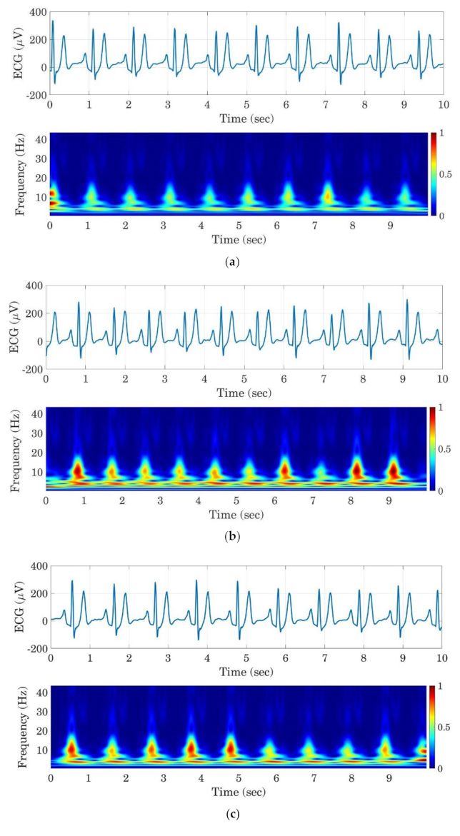 실험 대상이 졸음에 빠지는 과정에서 ECG 신호 주파수가 어떻게 증가하는지 보여주는 3개의 그래프. 경각 상태인 운전자의 주파수는 0.5Hz 미만이었지만 심한 졸음 상태의 운전자는 1Hz에 도달했습니다.