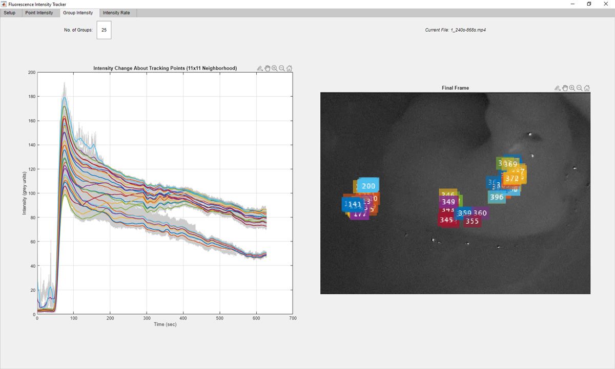 Graphic user interface showing a plot of intensity versus time mapped from an image of an endoscopy