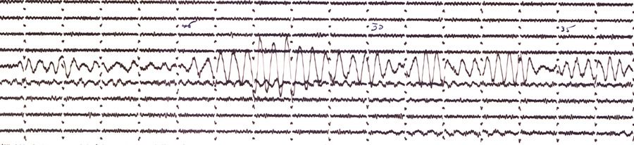 Figure 1. A 1938 analog seismogram in the Harvard-Adam Dziewoński Observatory collection.