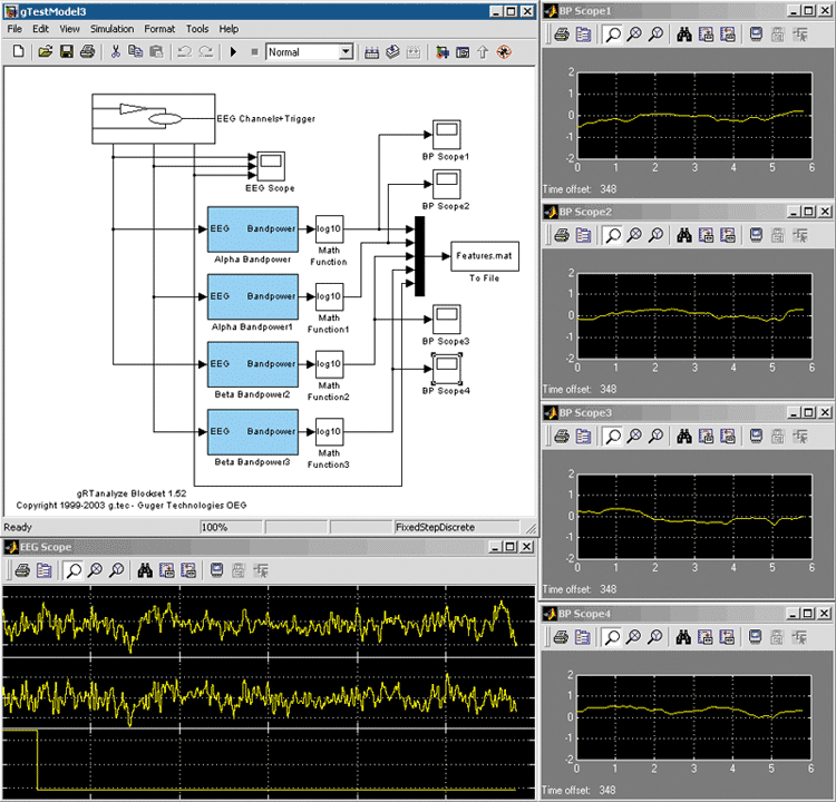 brain_ci_fig3_w.gif