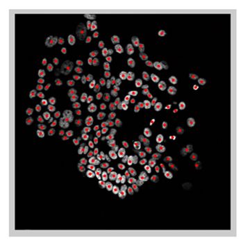 Figure 4. The processed image with each identified nucleus located and marked in red.