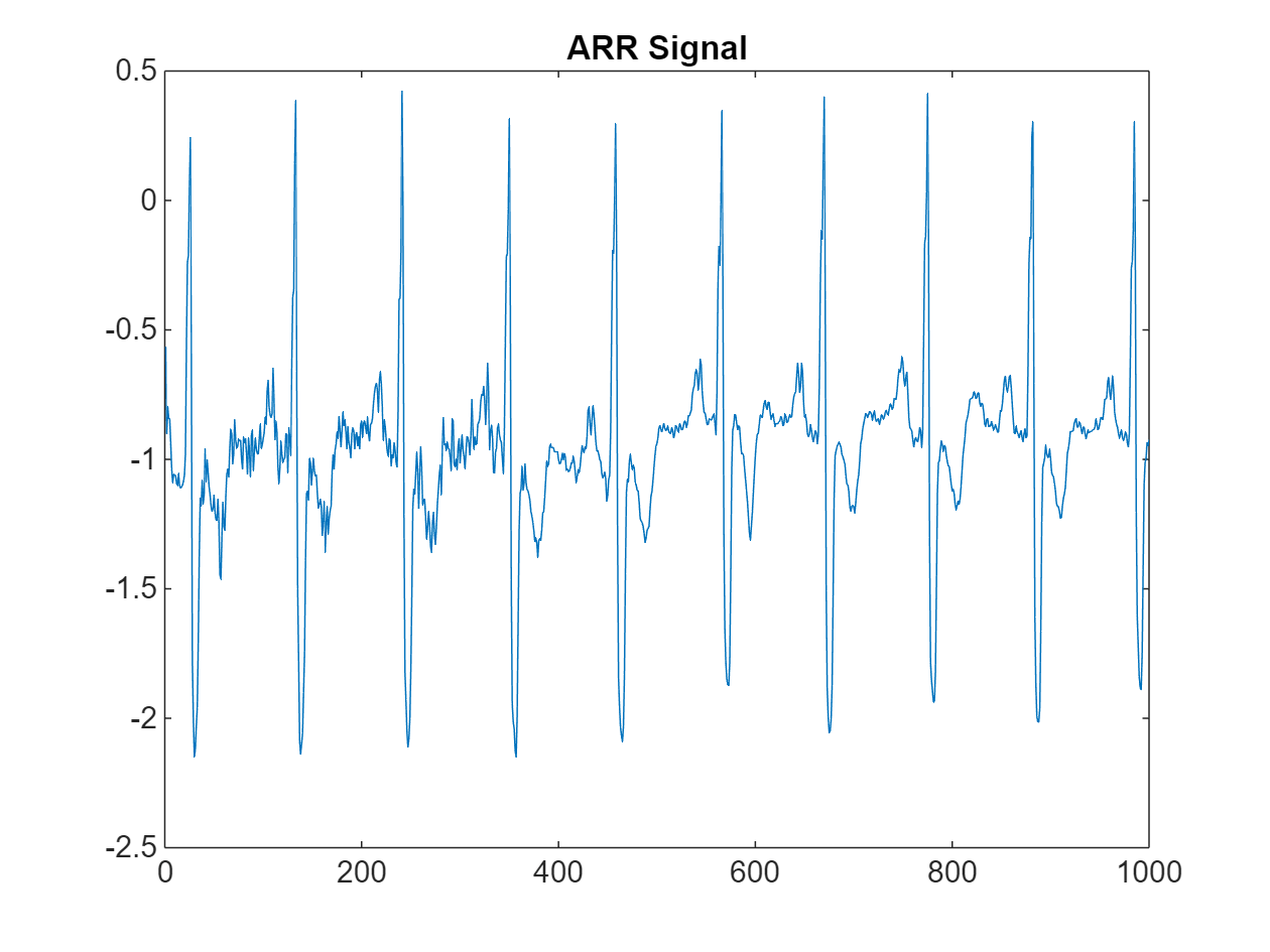 ecg signal using wavelet matlab code