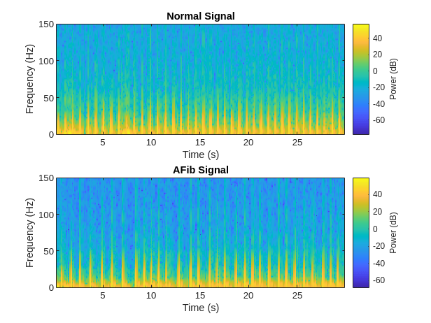 Classify ECG Signals Using Long Short-Term Memory Networks with GPU Acceleration