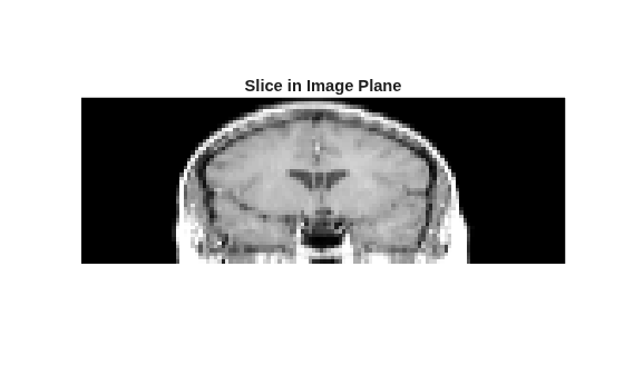 Figure contains an axes object. The hidden axes object with title Slice in Image Plane contains an object of type image.