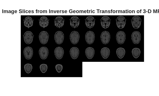 Figure contains an axes object. The hidden axes object with title Image Slices from Inverse Geometric Transformation of 3-D MRI contains an object of type image.