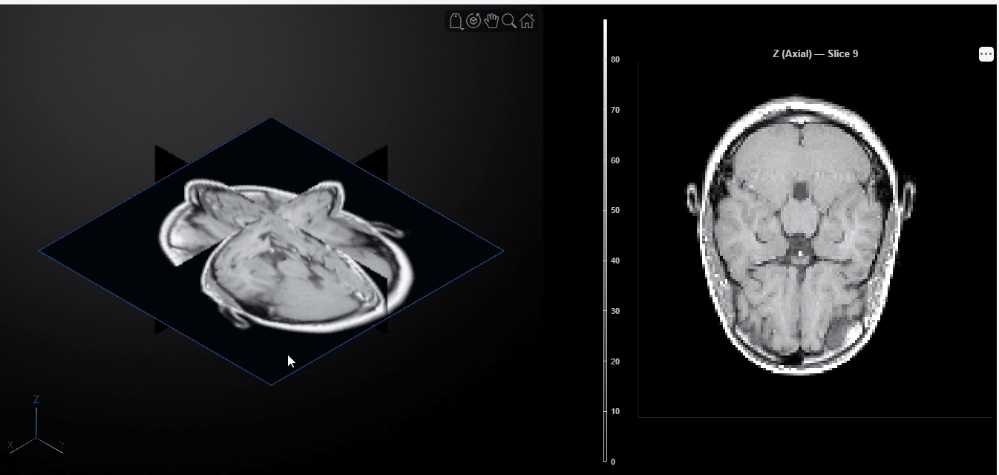 Three orthogonal slice planes through the MRI volume with a synchronized 2-D slice panel in gray colormap