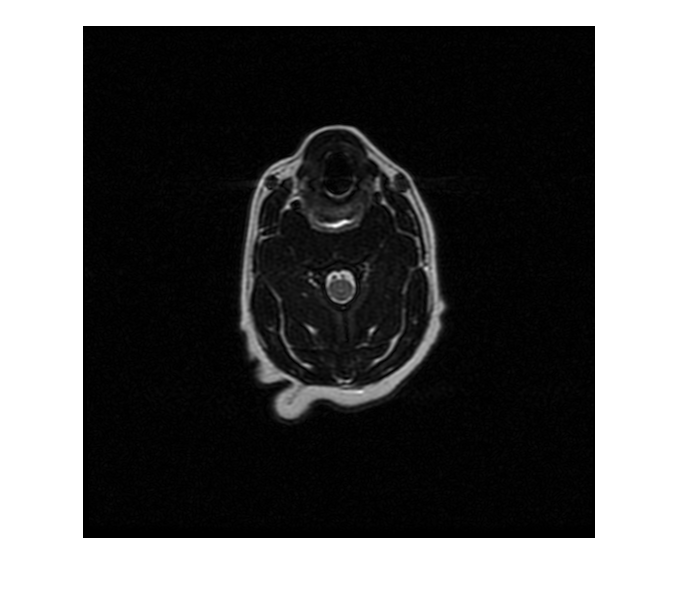 Create Image Datastore Containing DICOM Images