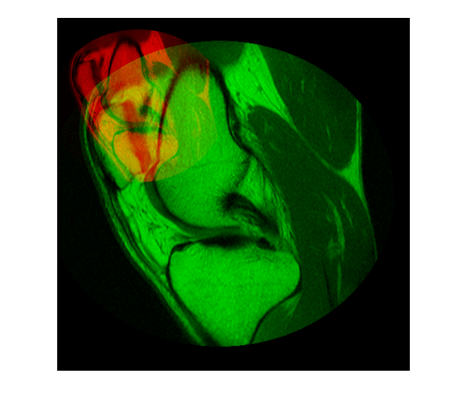 Figure contains an axes object. The axes object contains an object of type image.