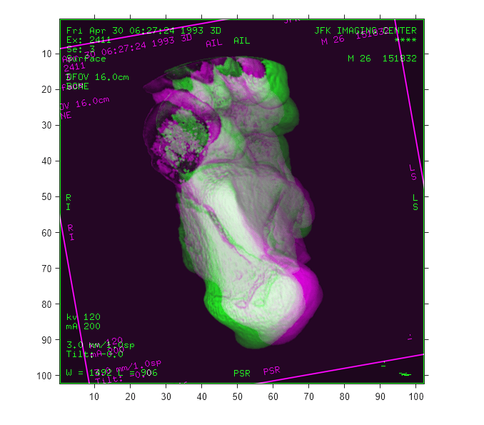 Figure contains an axes object. The axes object contains an object of type image.