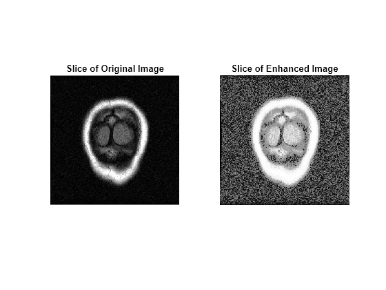 Figure contains 2 axes objects. Axes object 1 with title Slice of Original Image contains an object of type image. Axes object 2 with title Slice of Enhanced Image contains an object of type image.