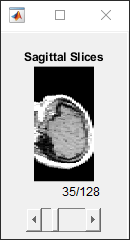 Slice viewer window showing sagittal slices scaled using the ScaleFactors name-value argument