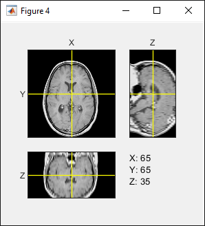 Orthoslice Viewer window showing resampled volume