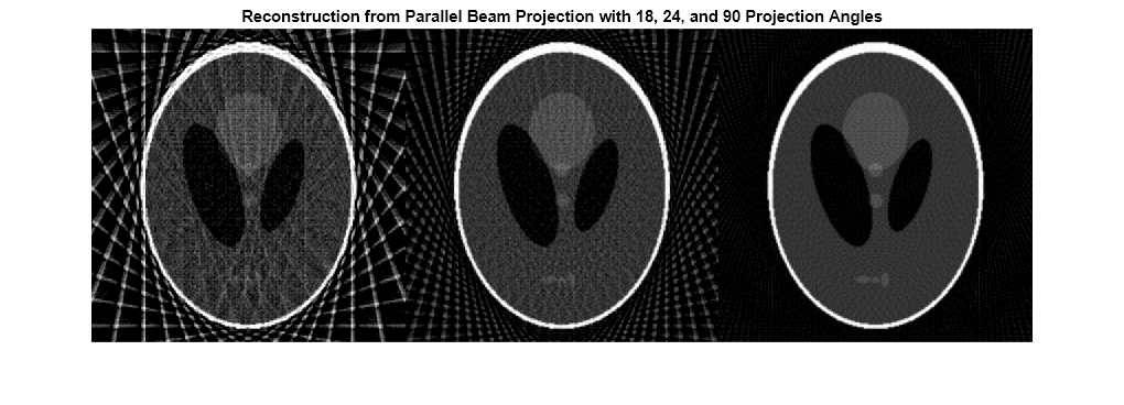 Figure contains an axes object. The axes object with title Reconstruction from Parallel Beam Projection with 18, 24, and 90 Projection Angles contains an object of type image.