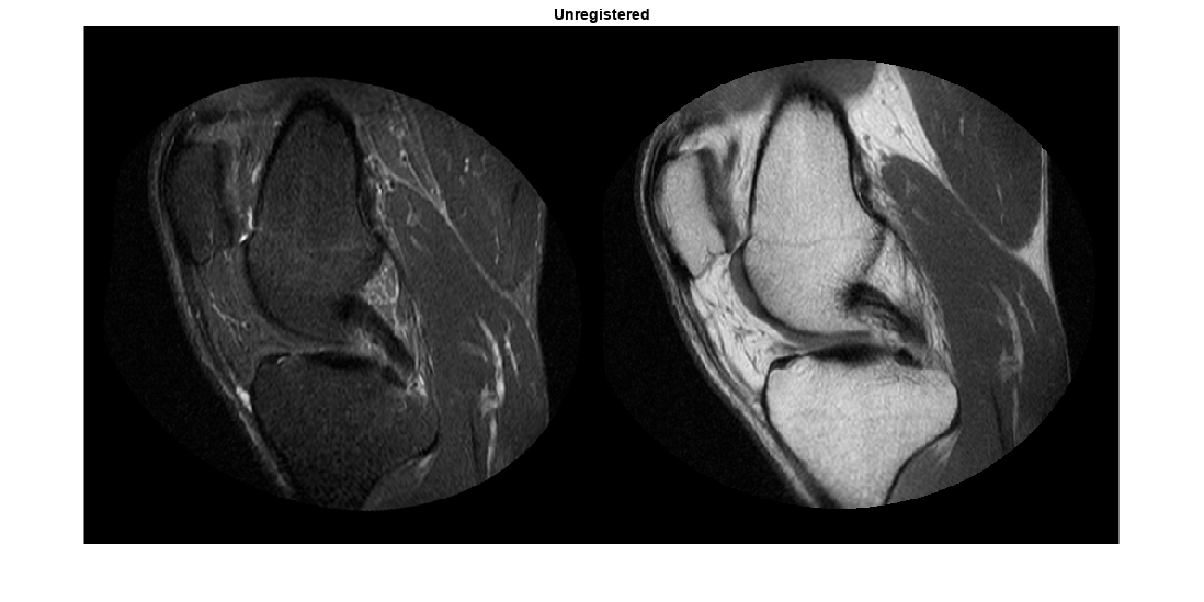 Register Multimodal MRI Images