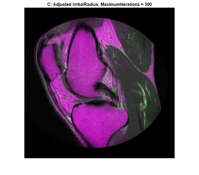 Figure contains an axes object. The axes object with title C: Adjusted InitialRadius, MaximumIterations = 300 contains an object of type image.