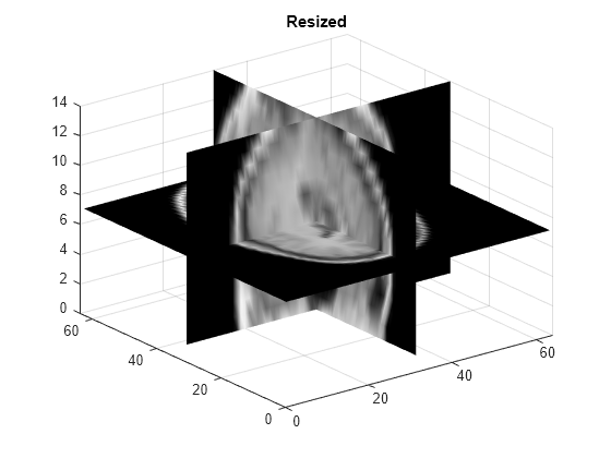 Figure contains an axes object. The axes object with title Resized contains 3 objects of type surface.