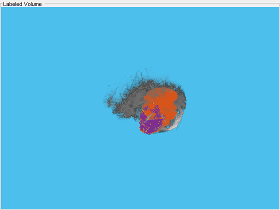 Display labeled volume - MATLAB - MathWorks 한국