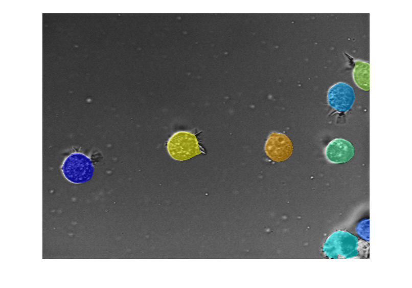 Refine Cellpose Segmentation by Tuning Model Parameters