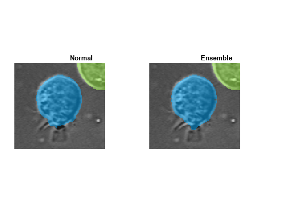 Figure contains 2 axes objects. Axes object 1 with title Normal contains an object of type image. Axes object 2 with title Ensemble contains an object of type image.