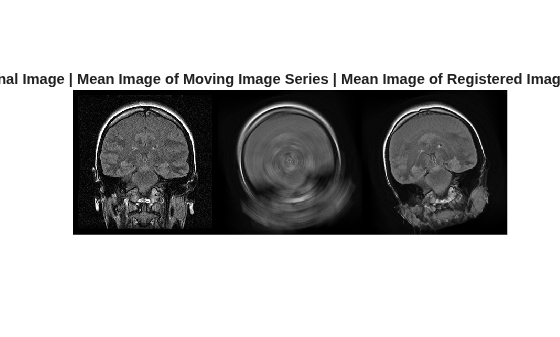 Figure contains an axes object. The hidden axes object with title Original Image | Mean Image of Moving Image Series | Mean Image of Registered Image Series contains an object of type image.
