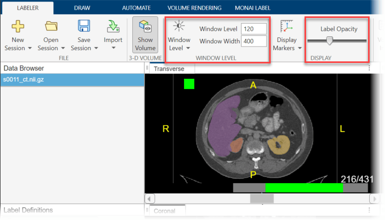 Labeler tab of the app toolstrip, with boxes highlighting the window level tool and the label opacity slider.