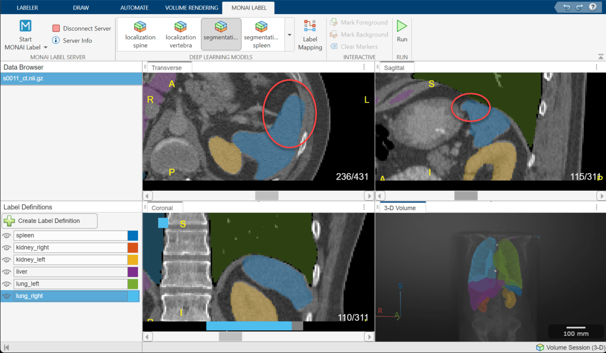 Medical Image Labeler window showing red circles that indicate areas of the spleen label that need refinement.
