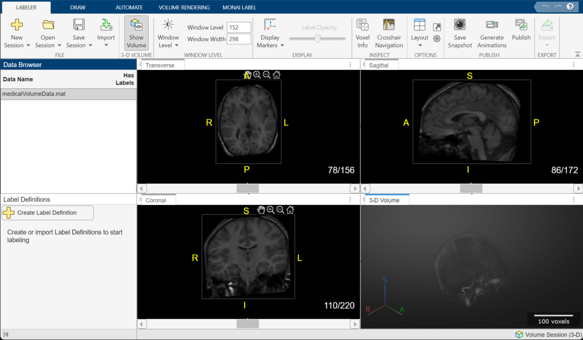 Medical Image Labeler app window after importing the registered MRI volume