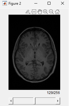 Slice viewer visualization of anatomical MRI volume.