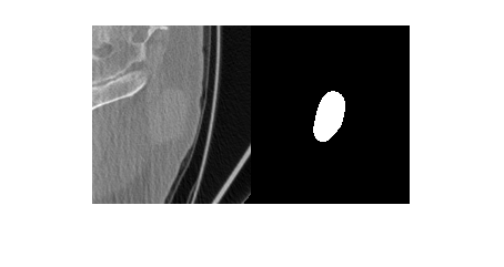 Figure contains an axes object. The hidden axes object contains an object of type image.