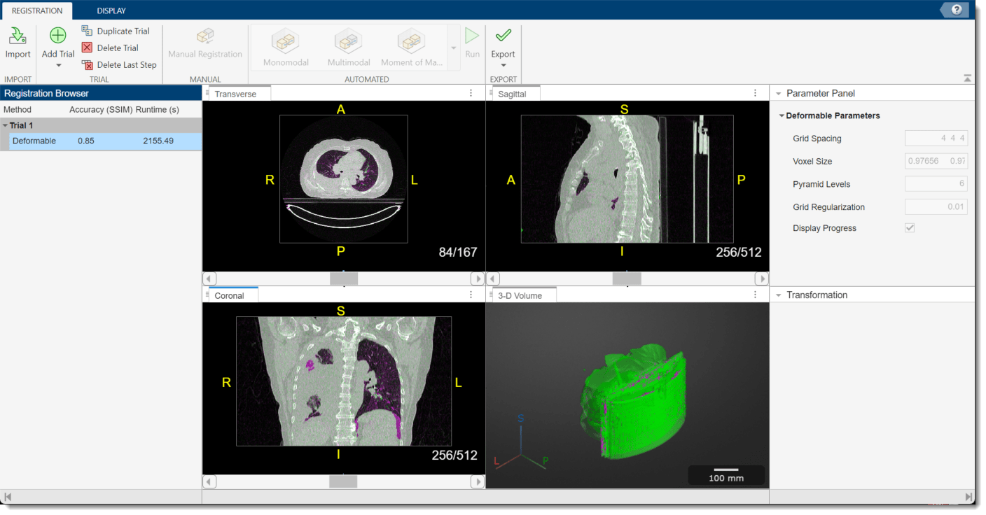 Medical Registration Estimator app window after running deformable registration