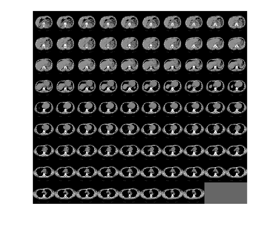 Figure contains an axes object. The axes object contains an object of type image.