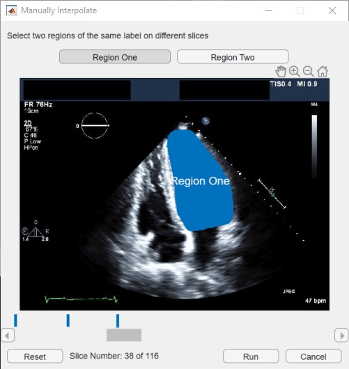 Select the ventricle label region in slice 38