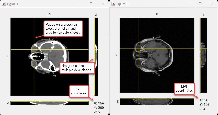 Annotated image of side-by-side orthosliceViewer windows showing selection of the right-eye control point in the CT (left) and MRI (Right) images