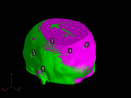 Figure contains an object of type images.ui.graphics3d.viewer3d.