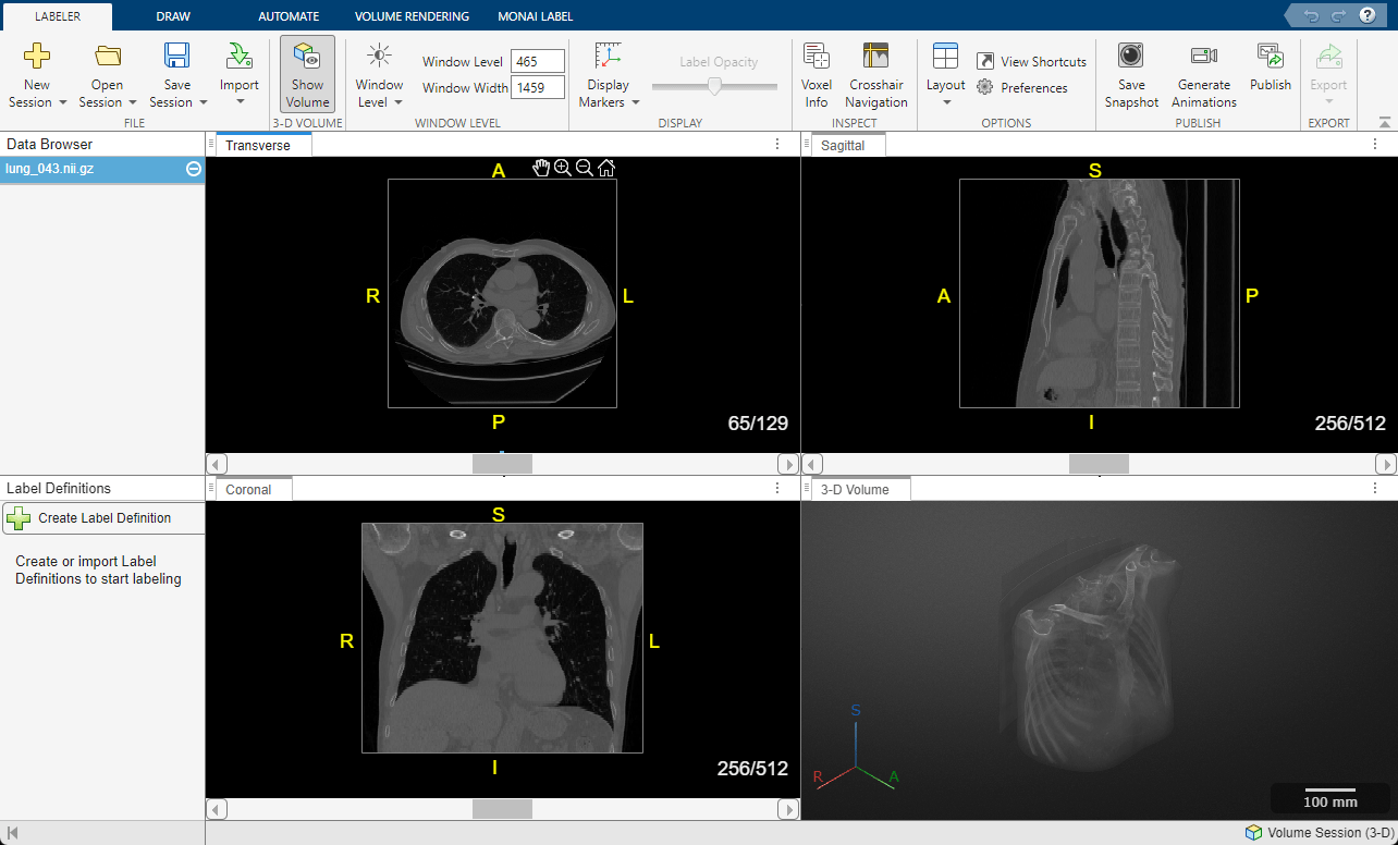 Medical Image Labeler window with a chest CT volume loaded in a volume session.