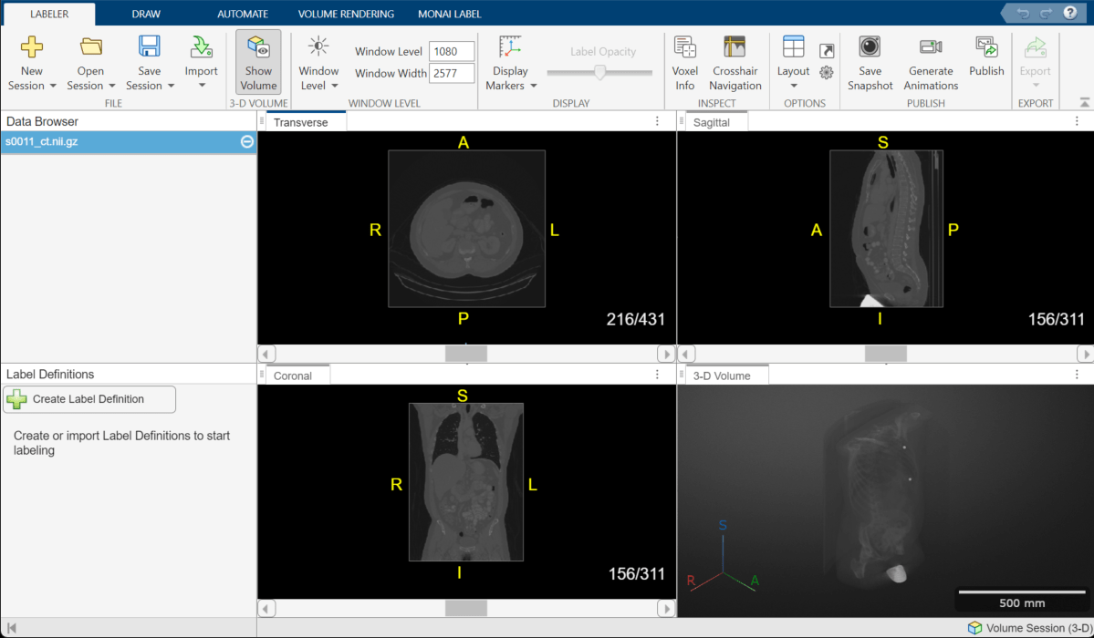 Select a MONAI Label model from the Deep Learning Models gallery in the MONAI Label tab of the app toolstrip.