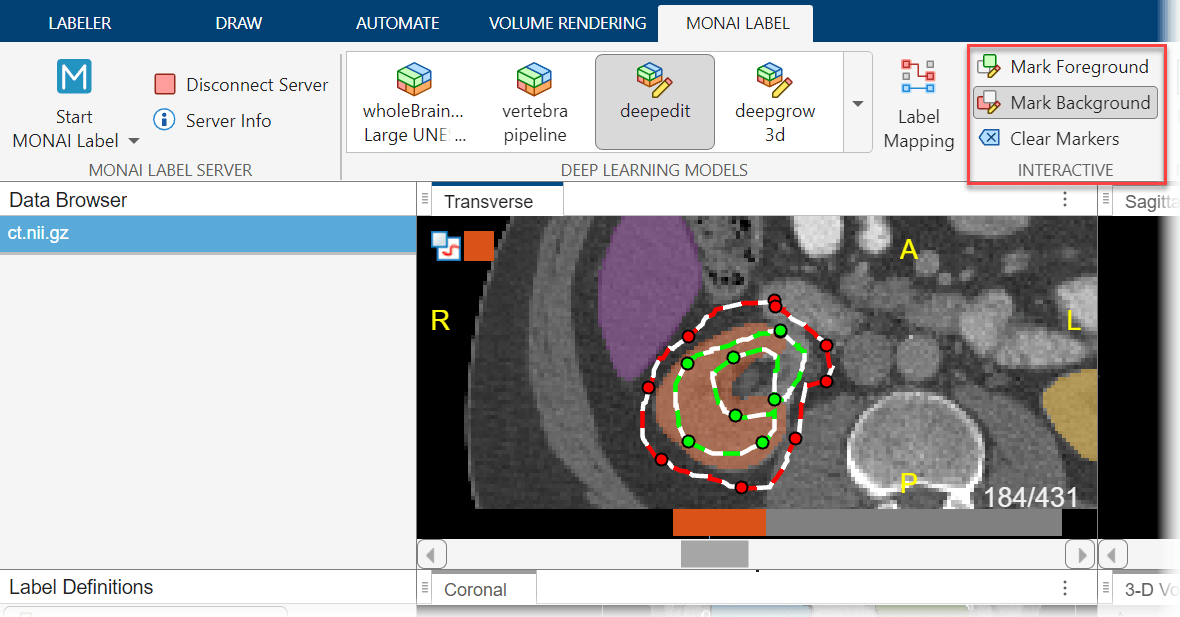 Manually refine the right kidney label by using the paintbrush tool in the Draw tab.