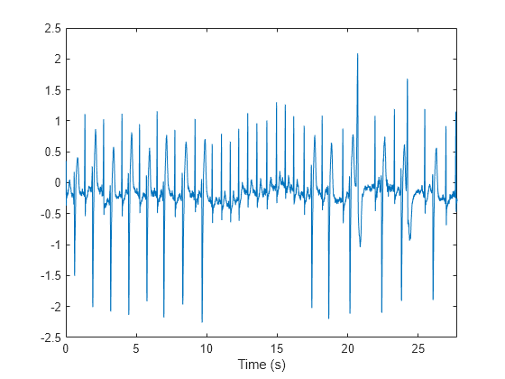 ecg signal using wavelet matlab code