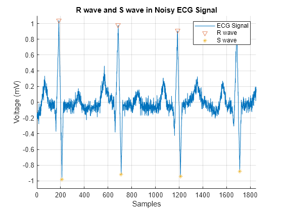 Figure contains an axes object. The axes object with title R wave and S wave in Noisy ECG Signal, xlabel Samples, ylabel Voltage(mV) contains 3 objects of type line. One or more of the lines displays its values using only markers These objects represent ECG Signal, R waves, S waves.