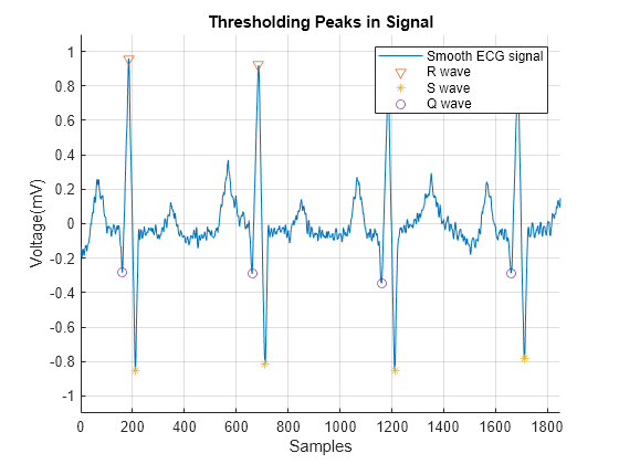 Figure contains an axes object. The axes object with title Thresholding Peaks in Signal, xlabel Samples, ylabel Voltage(mV) contains 4 objects of type line. One or more of the lines displays its values using only markers These objects represent Smooth ECG signal, Q wave, R wave, S wave.