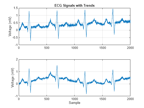 Figure contains 2 axes objects. Axes object 1 with title ECG Signals with Trends, ylabel Voltage (mV) contains an object of type line. Axes object 2 with xlabel Sample, ylabel Voltage (mV) contains an object of type line.