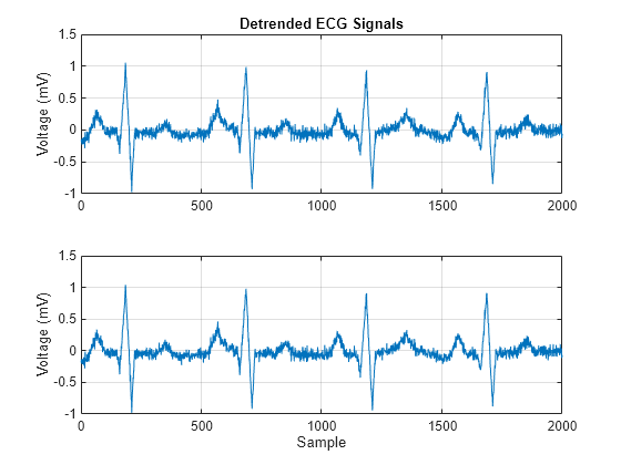 Figure contains 2 axes objects. Axes object 1 with title Detrended ECG Signals, ylabel Voltage (mV) contains an object of type line. Axes object 2 with xlabel Sample, ylabel Voltage (mV) contains an object of type line.