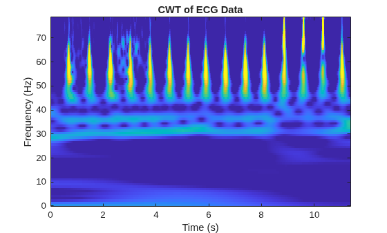 Figure contains an axes object. The axes object with title CWT of ECG Data, xlabel Time (s), ylabel Frequency (Hz) contains an object of type image.
