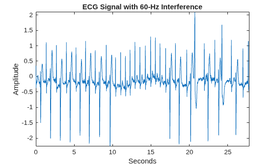 Figure contains an axes object. The axes object with title ECG Signal with 60-Hz Interference, xlabel Seconds, ylabel Amplitude contains an object of type line.