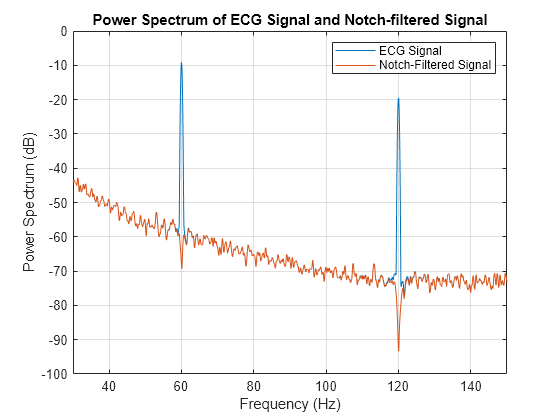 Figure contains an axes object. The axes object with title Power Spectrum of ECG Signal and Notch-filtered Signal, xlabel Frequency (Hz), ylabel Power Spectrum (dB) contains 2 objects of type line. These objects represent ECG Signal, Notch-Filtered Signal.