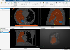 Label ground truth data using the Medical Image Labeler app.