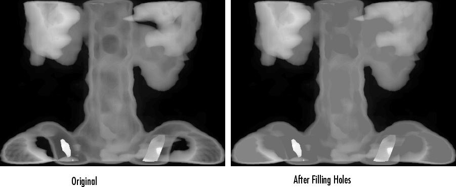 Holes in an image are filled in, or brightened, to match the intensity value of the surrounding region