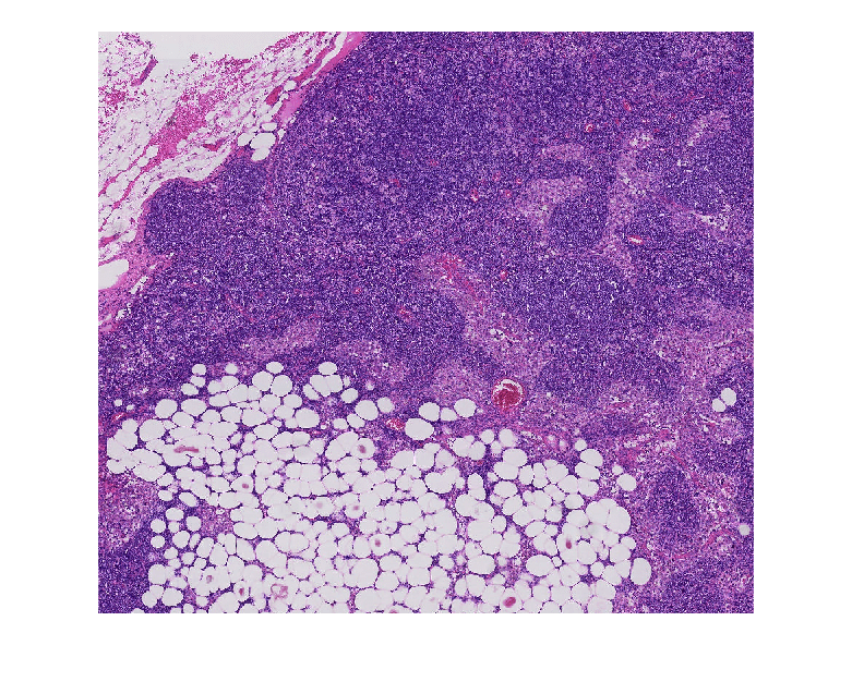 부분 영상 또는 낮은 해상도를 사용하여 효율적으로 블록 형식 영상 처리하기