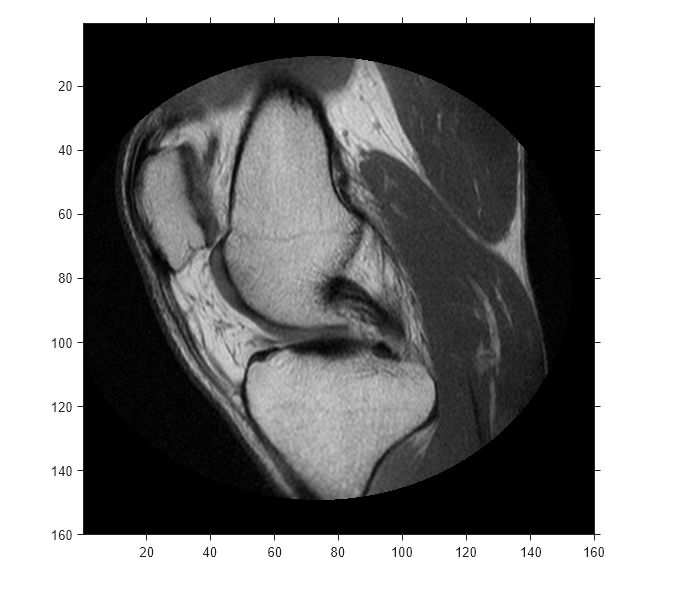 Figure contains an axes object. The axes object contains an object of type image.