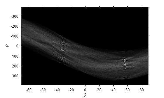 Figure contains an axes object. The axes object with xlabel theta, ylabel rho contains 2 objects of type image, line. One or more of the lines displays its values using only markers